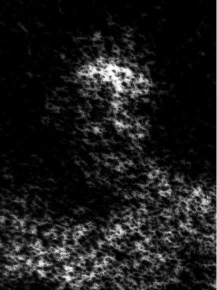 Micrograph