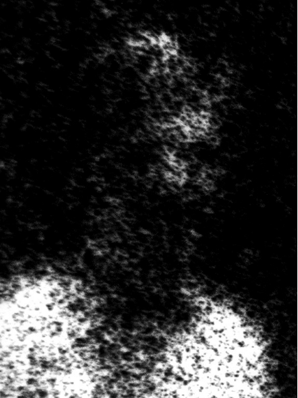 Micrograph