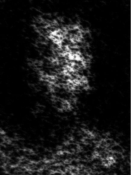 Micrograph