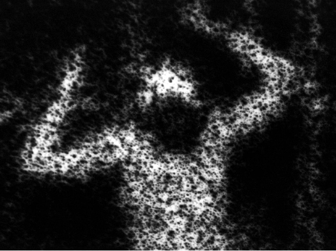 Micrograph