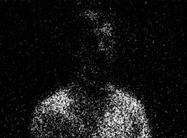Photomicrograph89