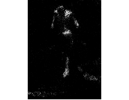 Photomicrograph196
